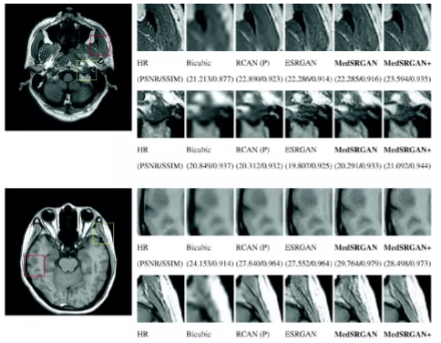 GAN generated medical scan images.